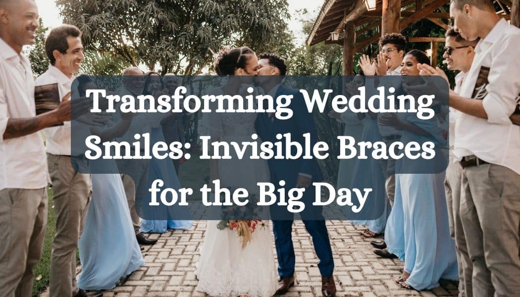 Transforming Wedding Smiles: Invisible Braces for the Big Day