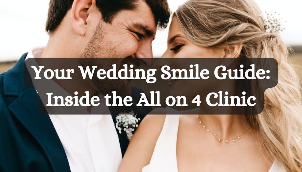 Your Wedding Smile Guide: Inside the All on 4 Clinic